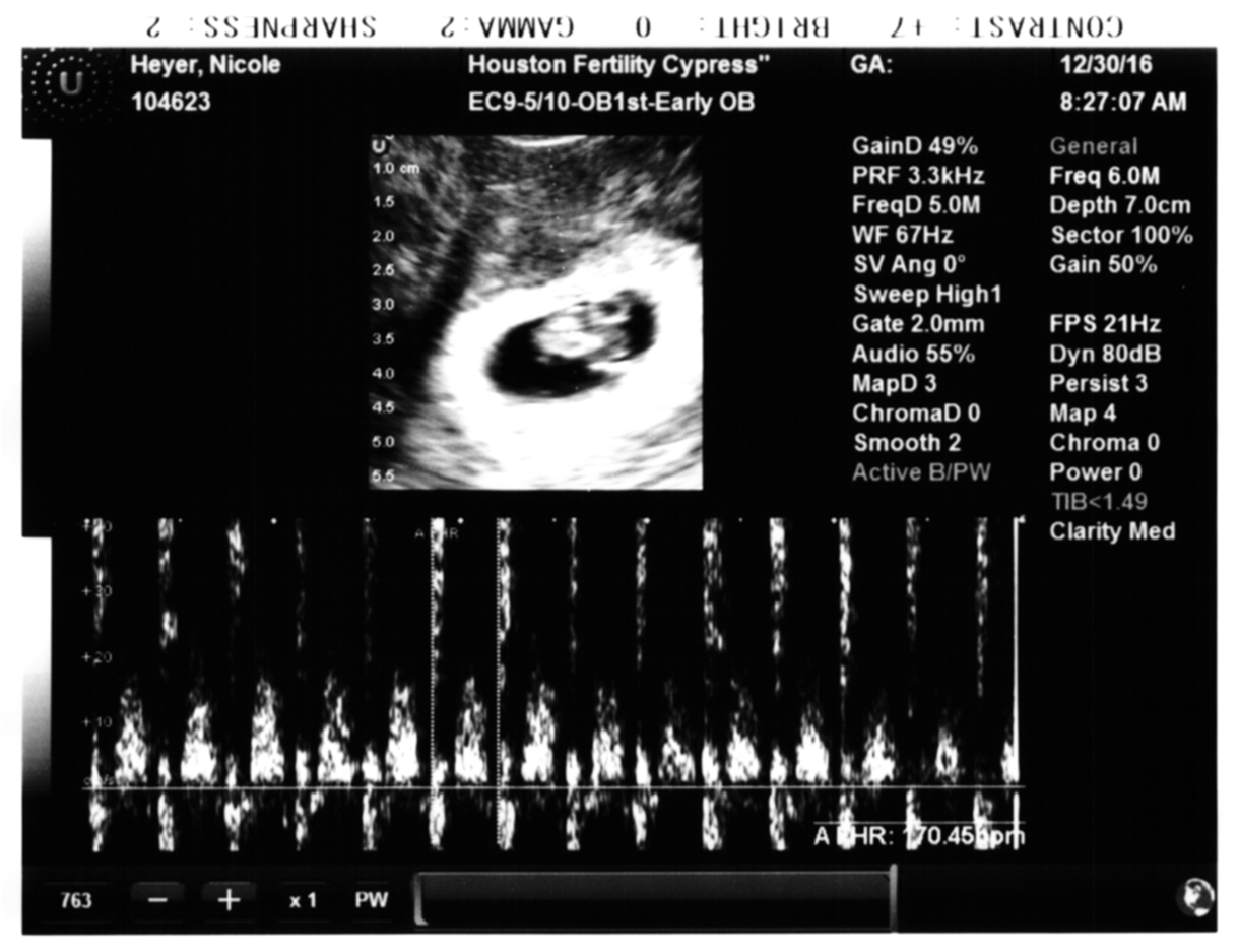 [Sonogram]