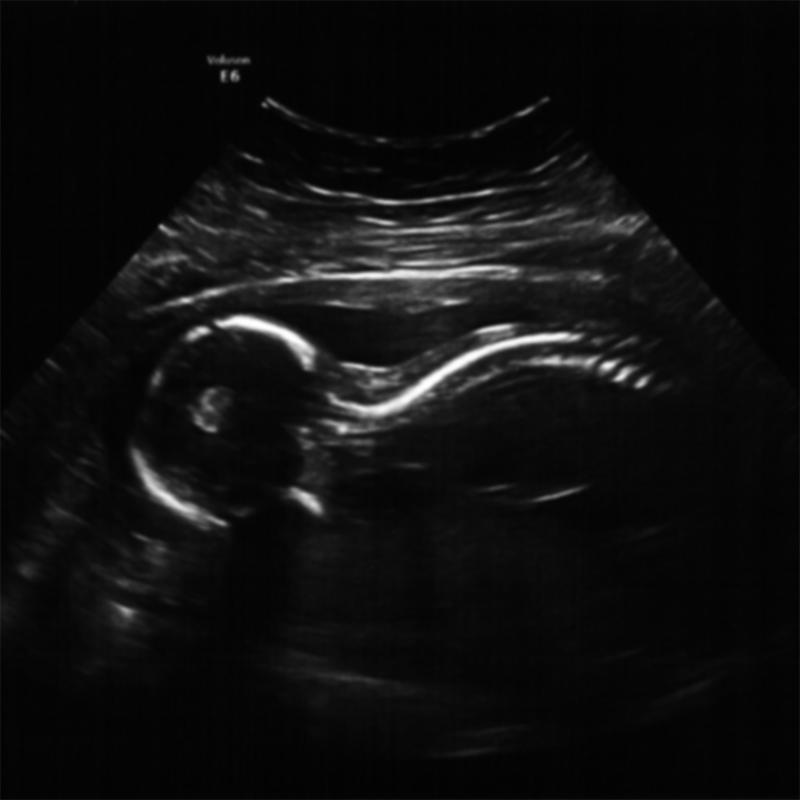 [Sonogram]